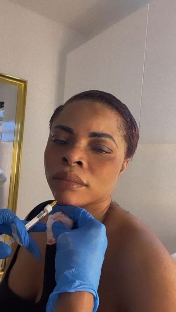 ‘Filler isn’t a plastic surgery, I have never done it in my life’ Laura Ikeji reacts after being dragged for getting chin fillers