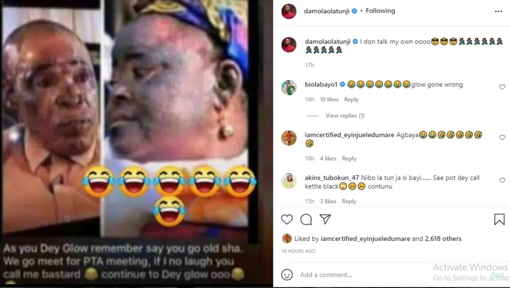 Damola Olatunji responds to fans who claim he bleached his skin.