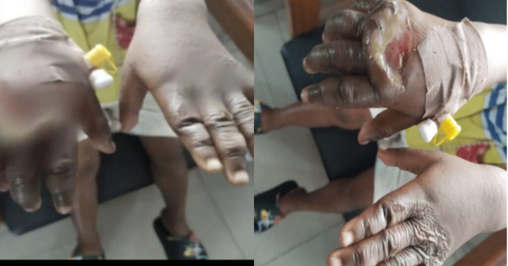 Mother puts five-year-old daughter’s hands in hot water for stealing fish in Cross River