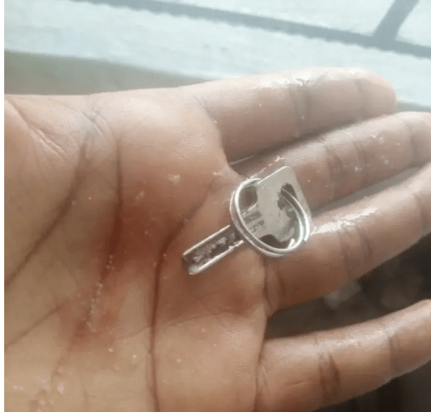 Nigerian mom grateful to God for saving her 1-year-old son after he swallowed a key