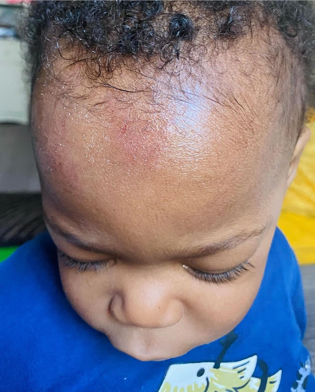 "I have never seen my baby get really hurt” – BBNaija Khafi cries out as her son sustains head injury (Photos)