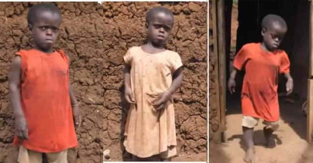 “She has never smiles before”- Meet a 20-years-old lady who looks like a 5-year-old girl