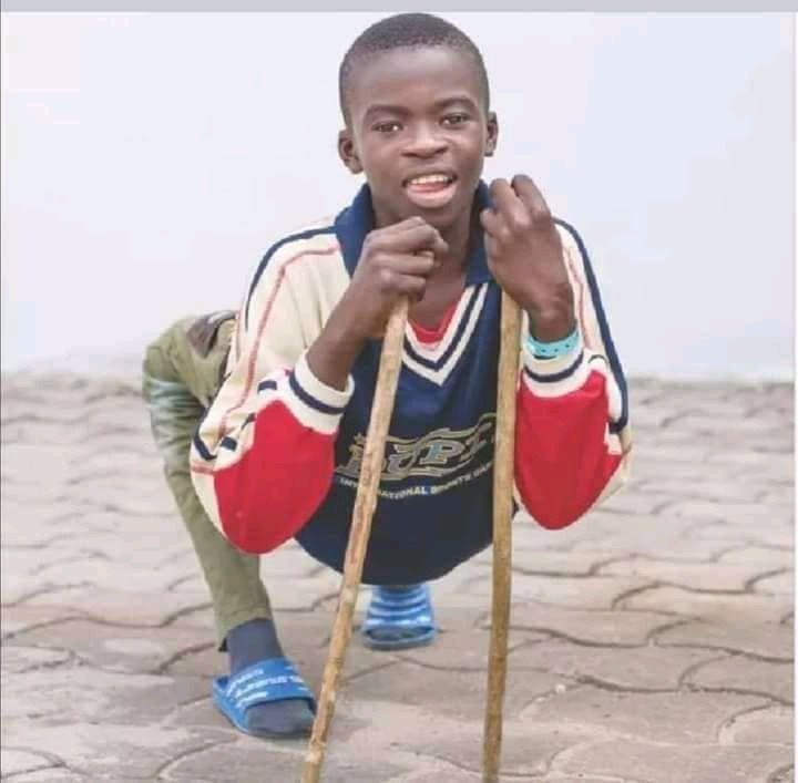 Nigerian Boy With Extreme Bow Legs Looks Totally Different After Undergoing Successful Surgery (Photos)