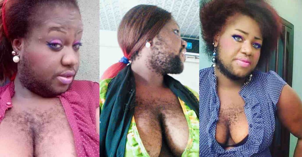 Meet The Nigerian Woman Who Have The Face Of A Man And Body Of A Woman (Photos)