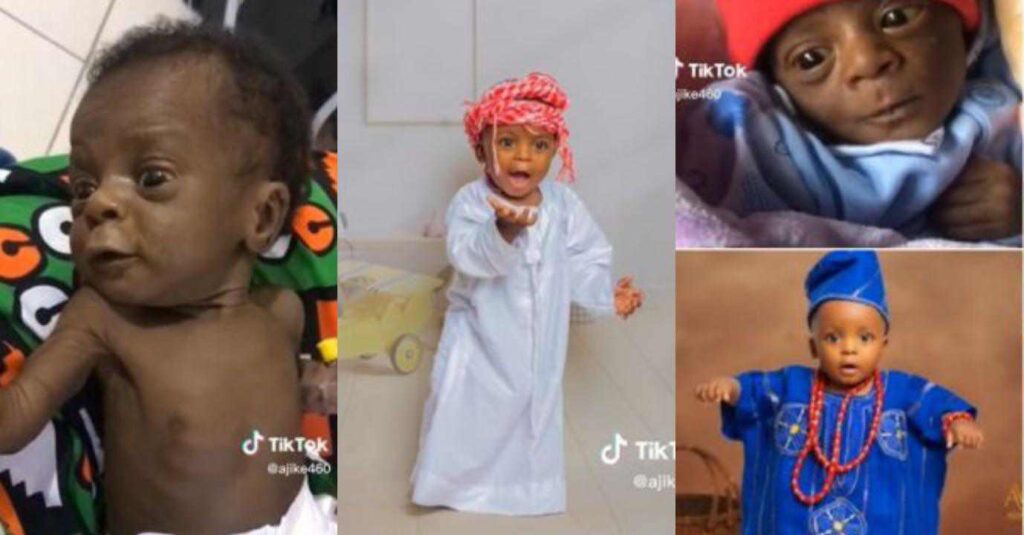 “Miracle no dey tire Jesus to do” – Woman shares ugly photos of her son on his 1st birthday, new transformation amazes many (Video)