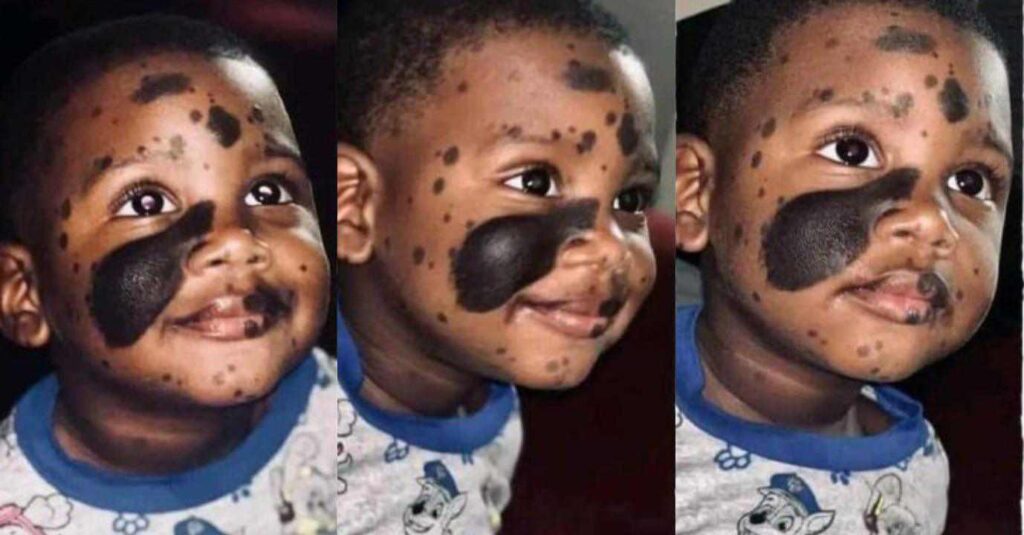 “Very Handsome”– Boy With Black Marks on His Face Trends Online as Cute Pictures Emerge.