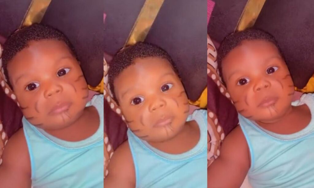 "He Look So Handsome Now With It"– Massive Reaction As Parent Share Video Of There Handsome Son With Tribal Mark (Watch)